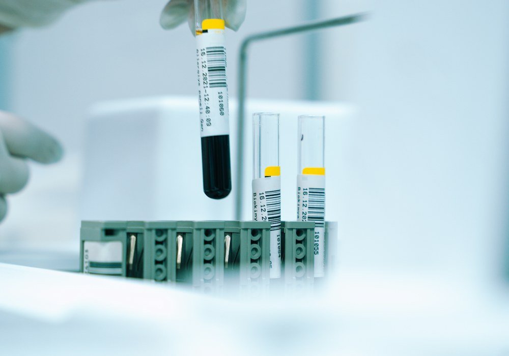 Stock photo of labeled laboratory sample tubes ready for testing